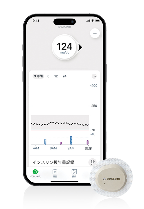 Dexcom G7 novo pen and device